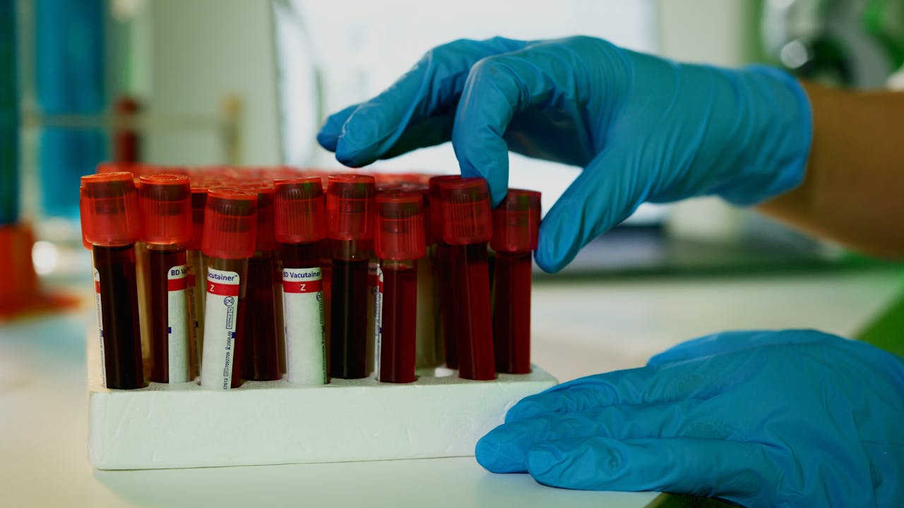 Health Check-up Packages A lab technician handles blood vials in a laboratory setting, showcasing medical research.