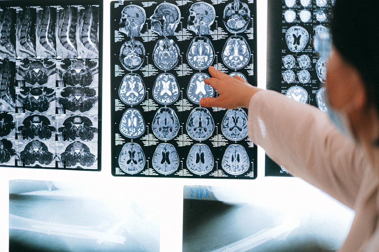 Health Check-up Packages Radiologist pointing at brain MRI scans showing detailed medical examination.