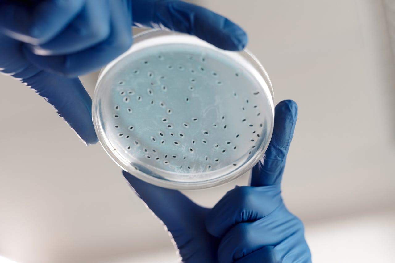 Health Check-up Packages Close-up of gloved hands holding a petri dish with bacterial cultures in a lab.